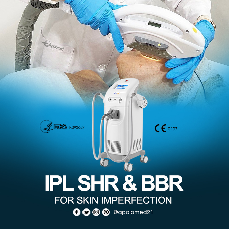 IPL SHR technology 660 3.9 فناوری IPL SHR 660 3.9