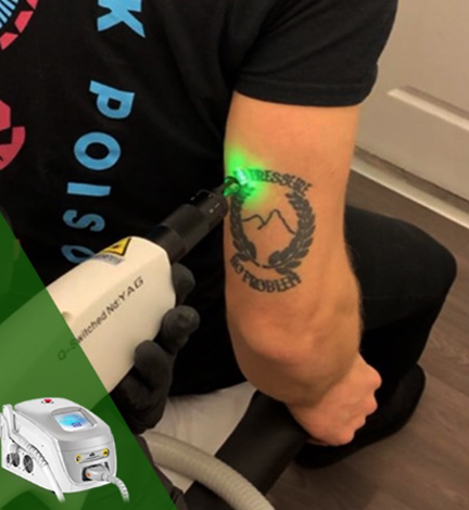 QS laser equipment 2 تجهیزات لیزر QS 2