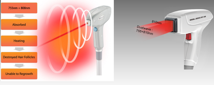 808 diode laser hair removal equipment تجهیزات لیزر دایود