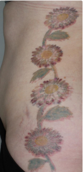 before 2 قبل از 2