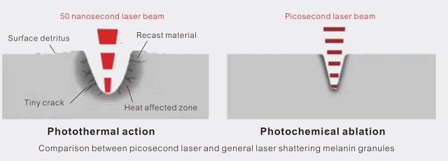 picosecond laser principle اصل لیزر پیکوثانیه