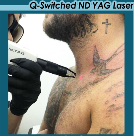 تجهیزات لیزر QS 1