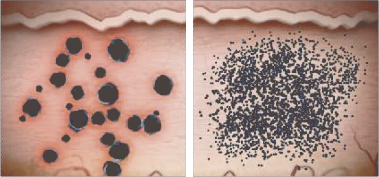 عمل فتوترمال