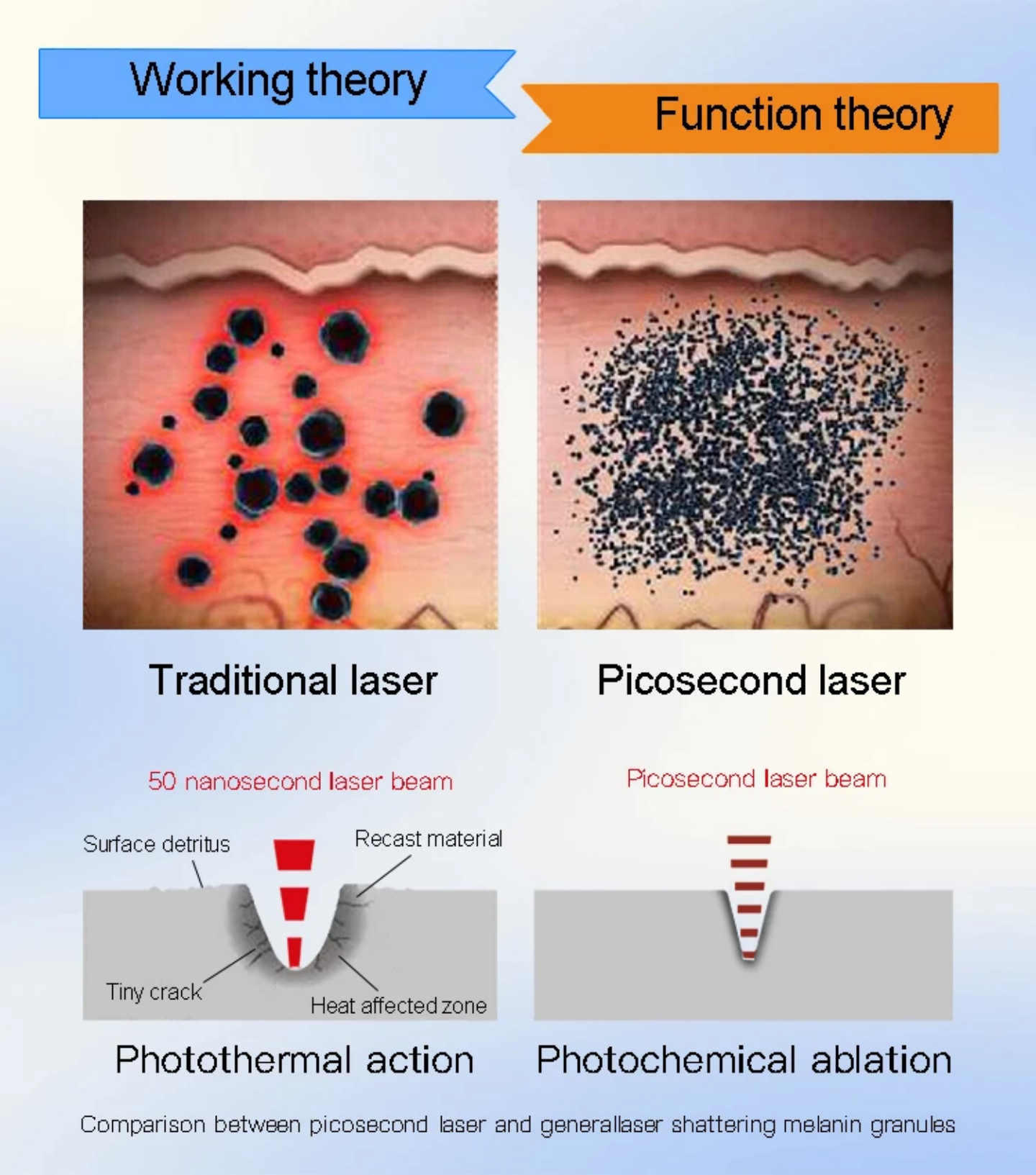 علم پشت تاتو لیزر چیست؟